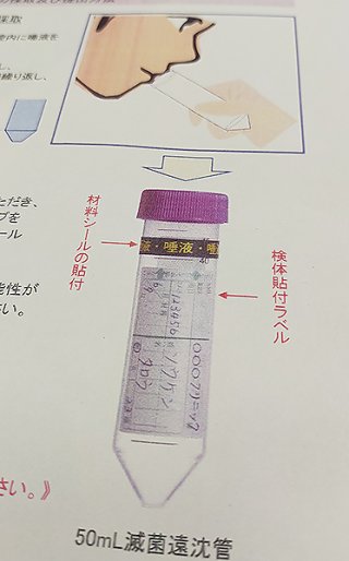 唾液でのＰＣＲ検査キットのイメージ図。唾液を容器に入れ検査機関に発送する